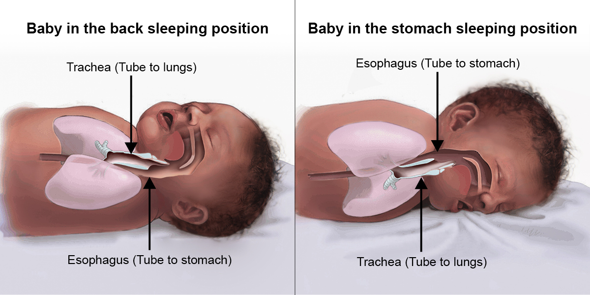 Anatomia sugarului previne aspirația și înecul atunci când bebelușul doarme pe spate.