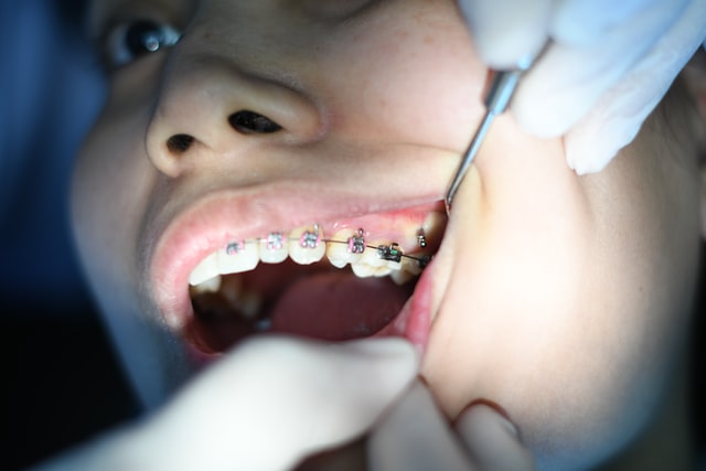 Tratamentele ortodontice la copii, gravide și mame ce alăptează